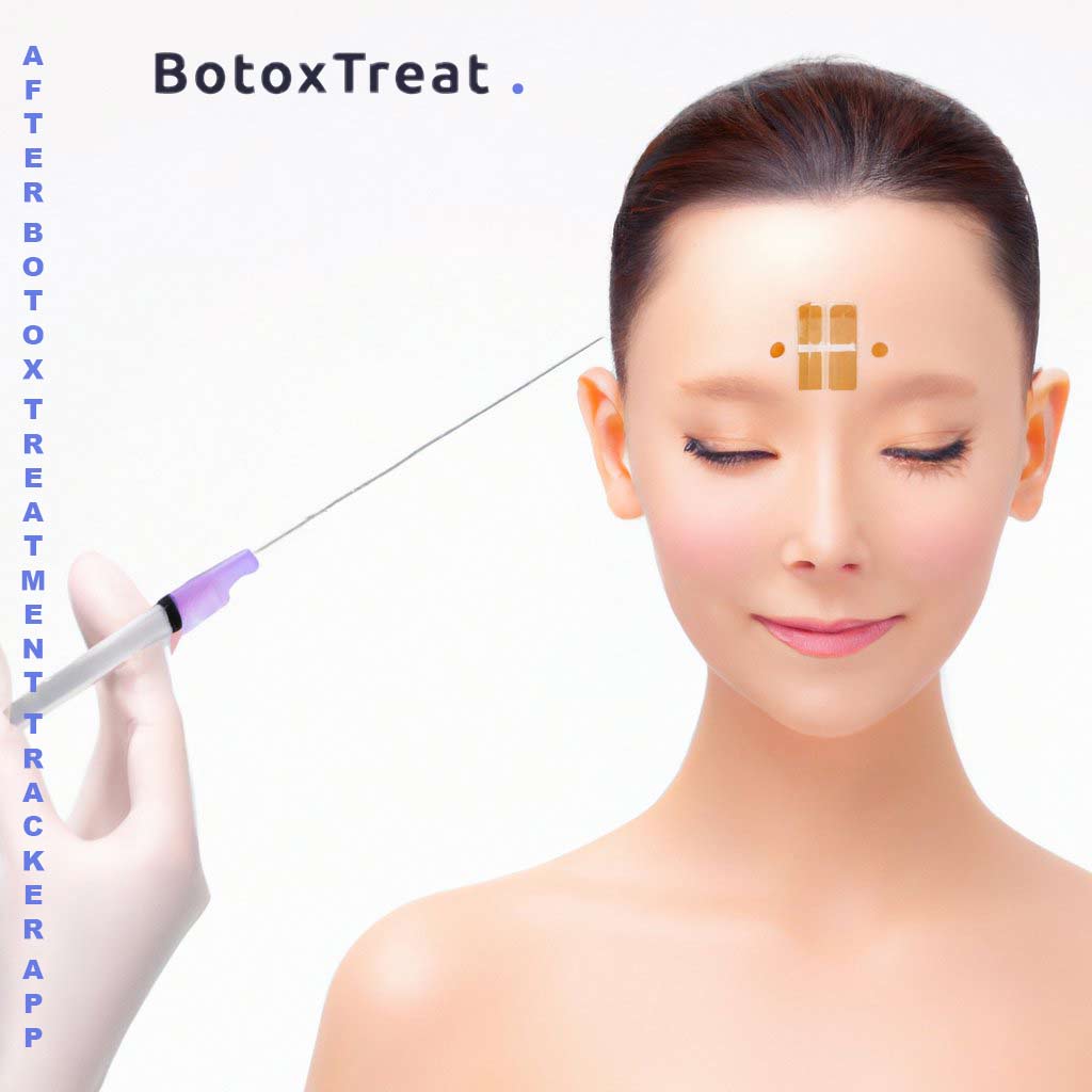 The ins and outs of Botox-BotoxTreat app
