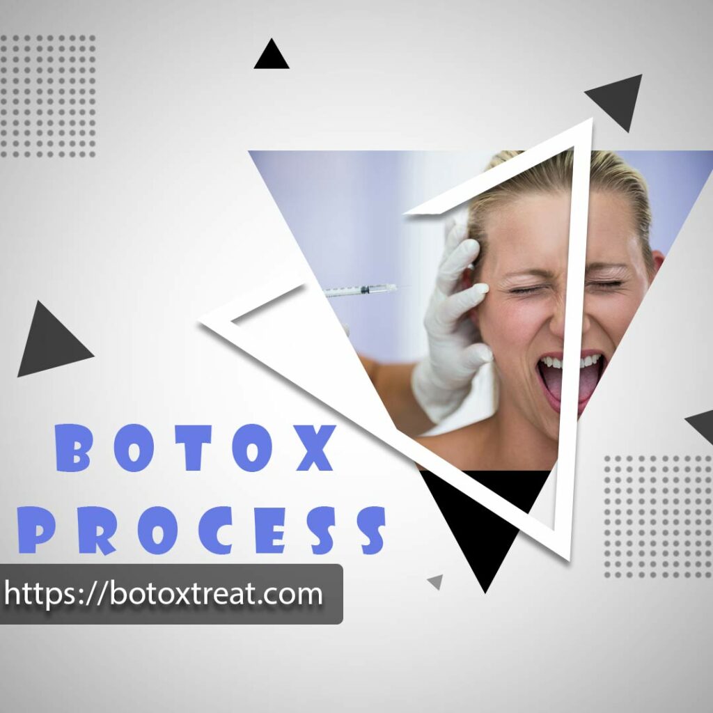 BotoxTreat Botox Process