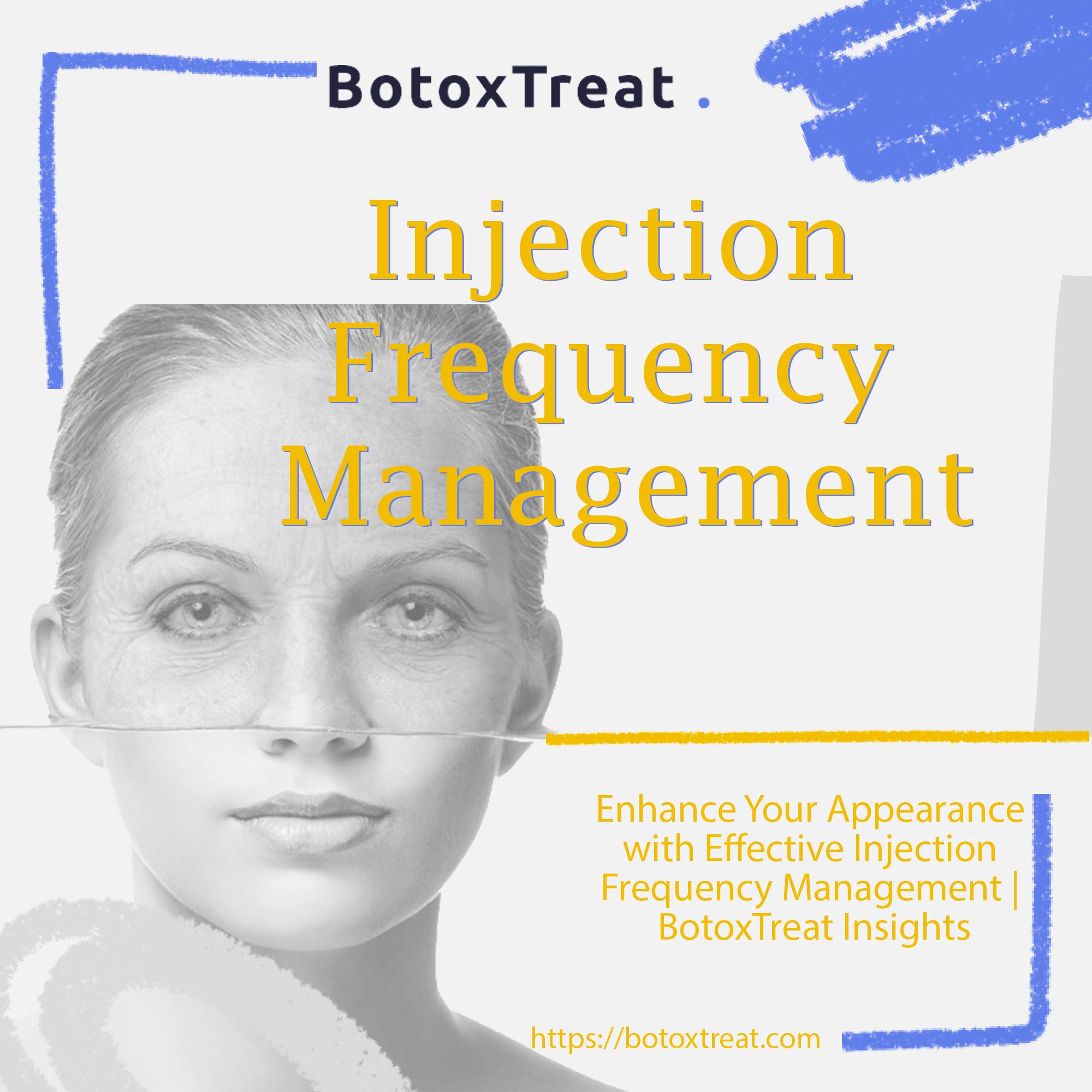Injection Frequency Management- BotoxTreat
