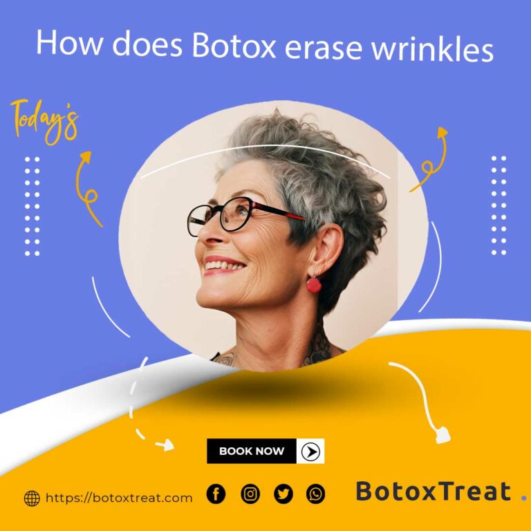 how-does-botox-erase-wrinkles-BotoxTreat