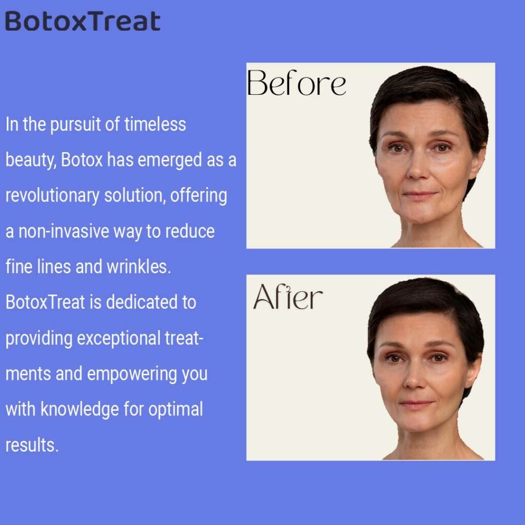 A Comprehensive Guide to Optimal Skincare with BotoxTreat