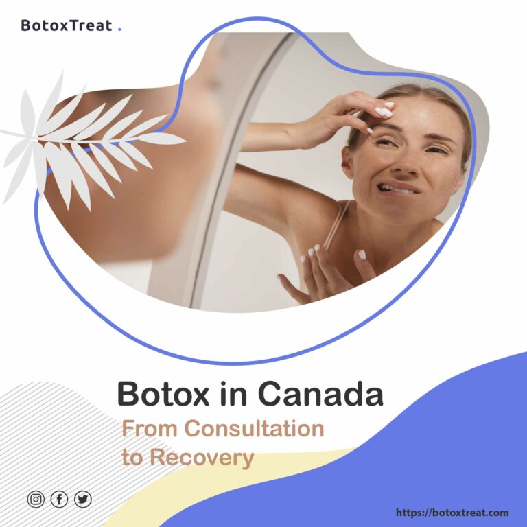 botox treatments - Botoxtreat app-Navigating the Botox experience in Canada