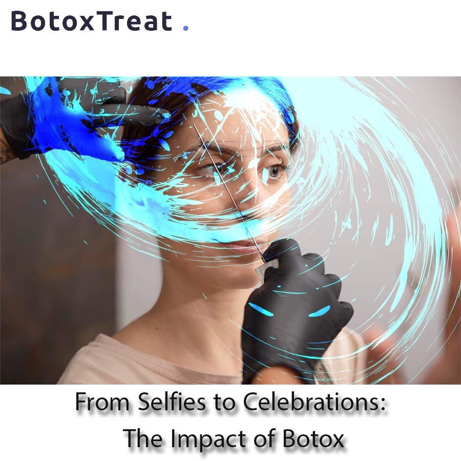 From Selfies to Celebrations: The Impact of Botox in Canada-BotoxTreat
